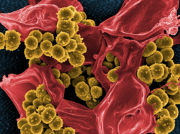 Staphylococcus-aureus-620×446