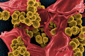 Staphylococcus-aureus-620×446
