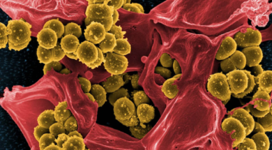 Staphylococcus-aureus-620×446
