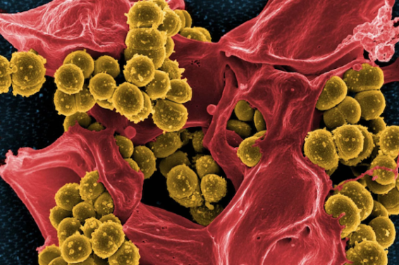 Staphylococcus-aureus-620×446